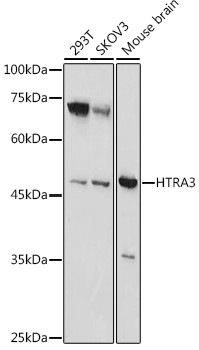 HTRA3 Antibody in Western Blot (WB)
