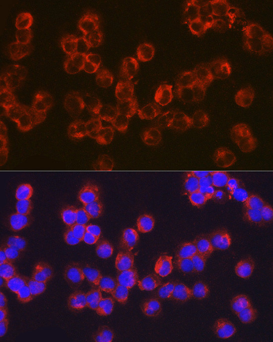 CD278 (ICOS) Antibody in Immunocytochemistry (ICC/IF)