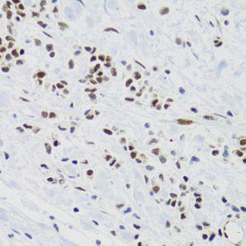 SUMO2 Antibody in Immunohistochemistry (Paraffin) (IHC (P))