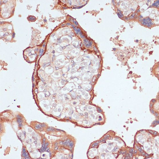GP130 Antibody in Immunohistochemistry (Paraffin) (IHC (P))