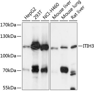 ITIH3 Antibody in Western Blot (WB)
