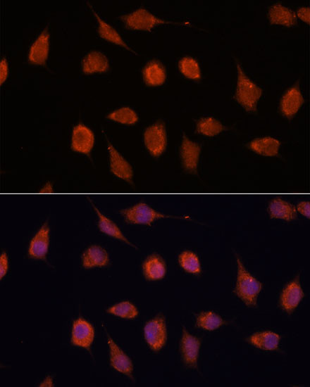 KCNAB2 Antibody in Immunocytochemistry (ICC/IF)