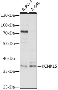 KCNK15 Antibody in Western Blot (WB)