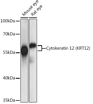 KRT12 Antibody in Western Blot (WB)