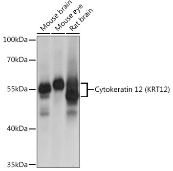 KRT12 Antibody in Western Blot (WB)