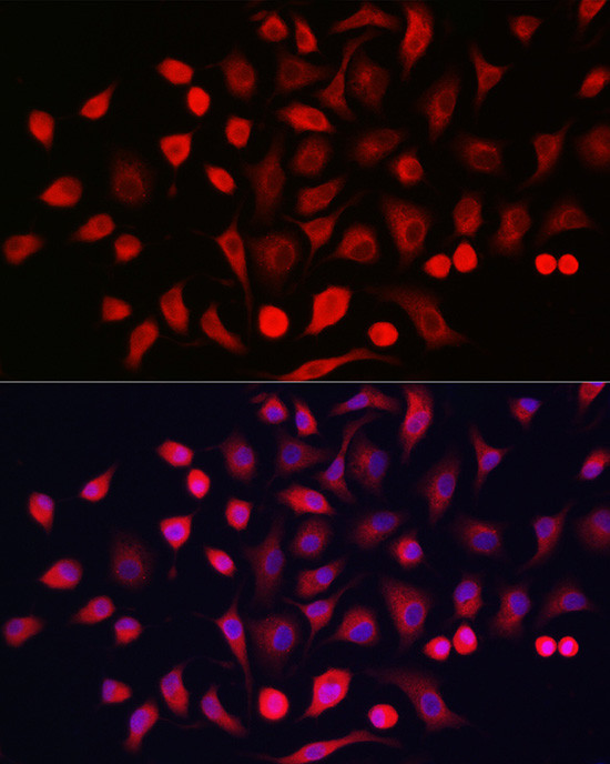 KRT16 Antibody in Immunocytochemistry (ICC/IF)