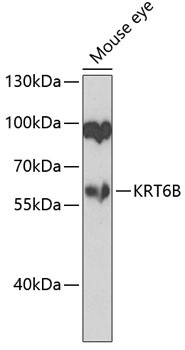 Cytokeratin 6B Antibody in Western Blot (WB)
