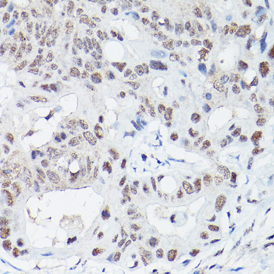 LIG4 Antibody in Immunohistochemistry (Paraffin) (IHC (P))