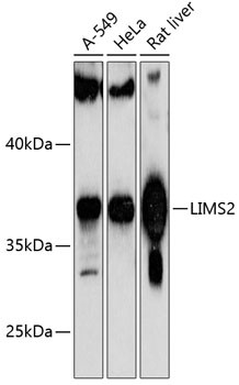 LIMS2 Antibody in Western Blot (WB)