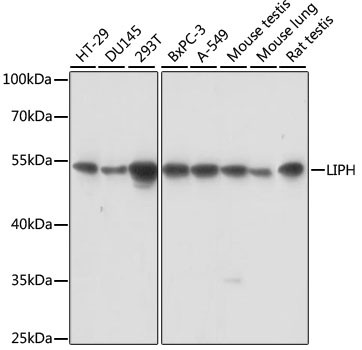 LIPH Antibody in Western Blot (WB)