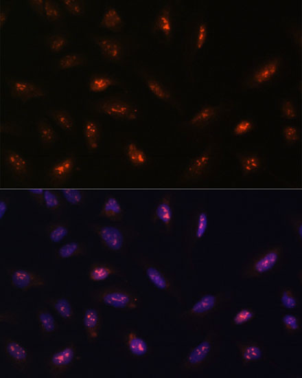 LLPH Antibody in Immunocytochemistry (ICC/IF)