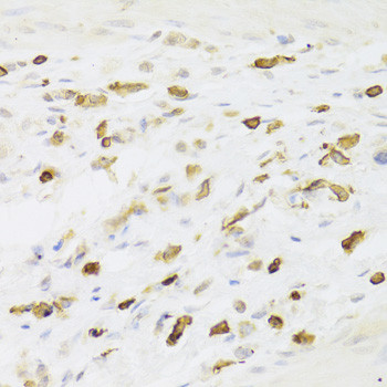 LSP1 Antibody in Immunohistochemistry (Paraffin) (IHC (P))