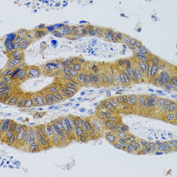 MBL2 Antibody in Immunohistochemistry (Paraffin) (IHC (P))