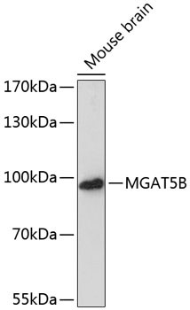 MGAT5B Antibody in Western Blot (WB)