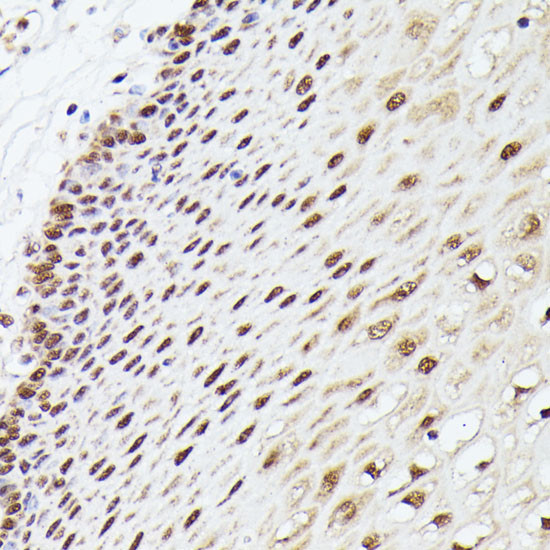MLF2 Antibody in Immunohistochemistry (Paraffin) (IHC (P))