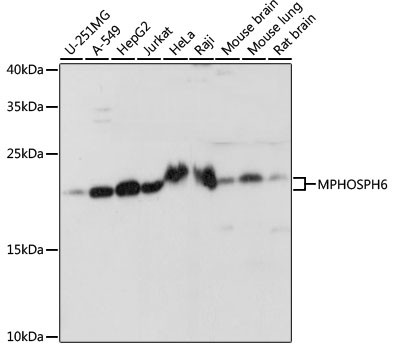 MPHOSPH6 Antibody in Western Blot (WB)