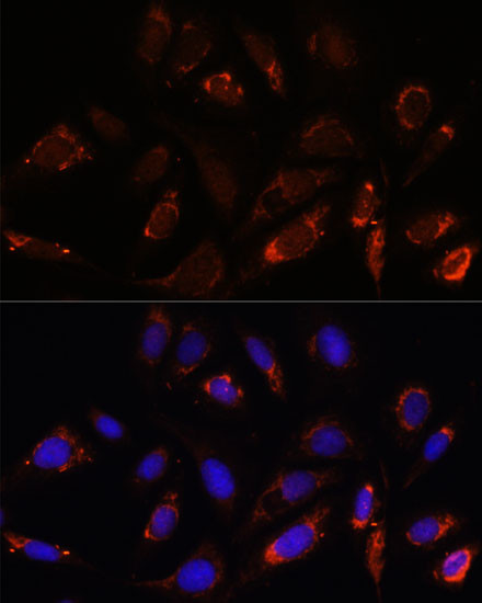 MRPL23 Antibody in Immunocytochemistry (ICC/IF)