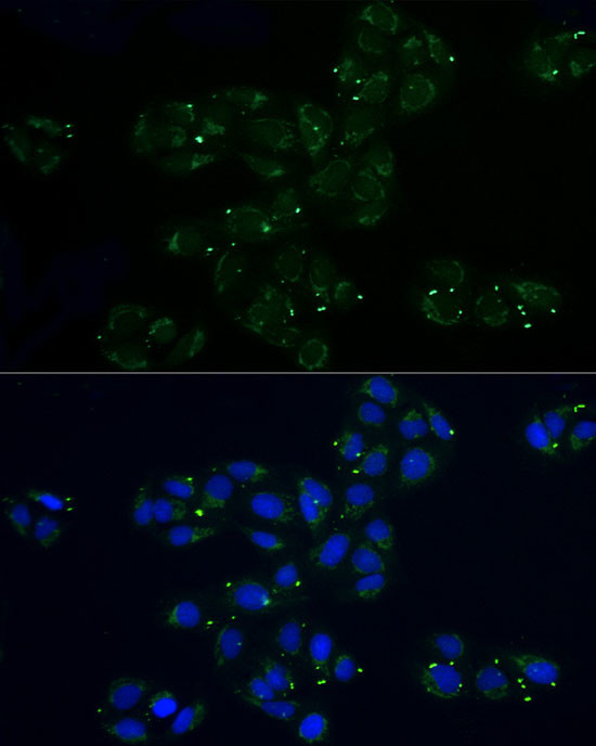 MRPL32 Antibody in Immunocytochemistry (ICC/IF)