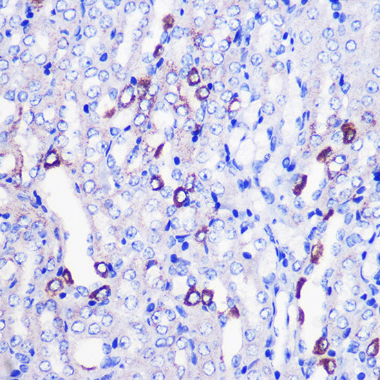 MRPL38 Antibody in Immunohistochemistry (Paraffin) (IHC (P))