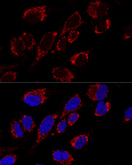 MRPS31 Antibody in Immunocytochemistry (ICC/IF)