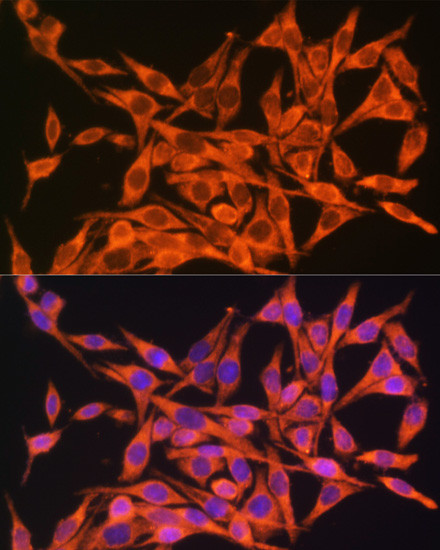 MT-ATP8 Antibody in Immunocytochemistry (ICC/IF)