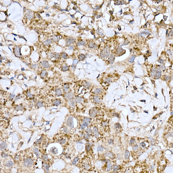 MT-ND6 Antibody in Immunohistochemistry (Paraffin) (IHC (P))