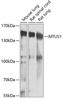 MTUS1 Antibody in Western Blot (WB)