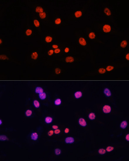 MYCT1 Antibody in Immunocytochemistry (ICC/IF)