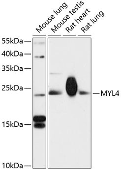 MYL4 Antibody in Western Blot (WB)