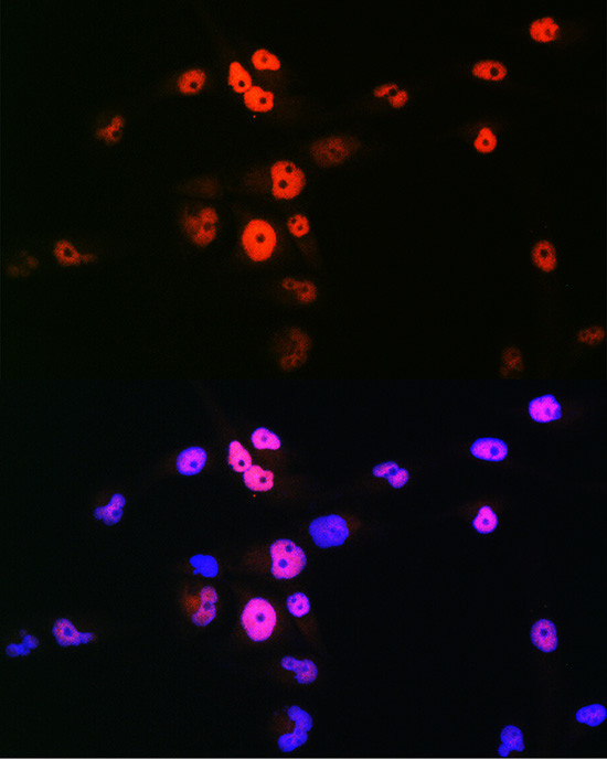 MYOD Antibody in Immunocytochemistry (ICC/IF)