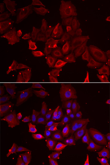 Myotilin Antibody in Immunocytochemistry (ICC/IF)