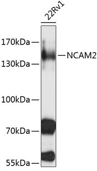 NCAM2 Antibody in Western Blot (WB)