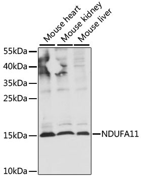 NDUFA11 Antibody in Western Blot (WB)
