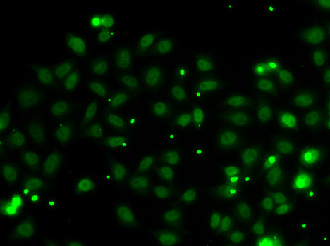 NADE Antibody in Immunocytochemistry (ICC/IF)