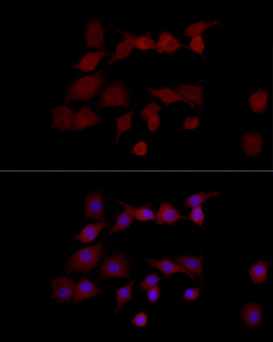 NGLY1 Antibody in Immunocytochemistry (ICC/IF)