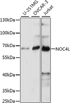 NOC4L Antibody in Western Blot (WB)