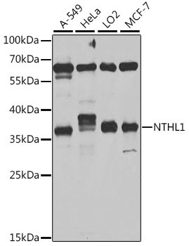 NTHL1 Antibody in Western Blot (WB)