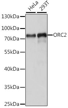 ORC2 Antibody in Western Blot (WB)