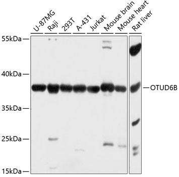 OTUD6B Antibody in Western Blot (WB)