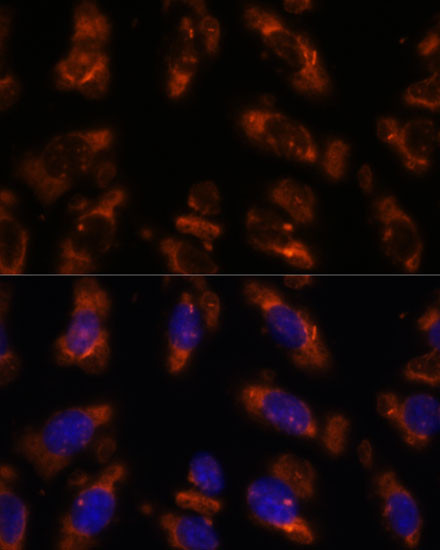 PDE6G Antibody in Immunocytochemistry (ICC/IF)