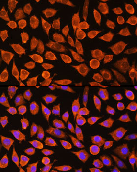 PDXP Antibody in Immunocytochemistry (ICC/IF)