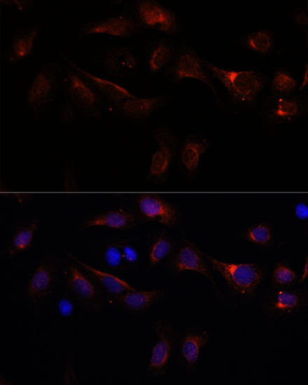 PFDN4 Antibody in Immunocytochemistry (ICC/IF)