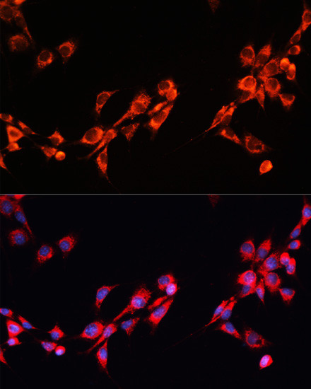 PGRMC2 Antibody in Immunocytochemistry (ICC/IF)