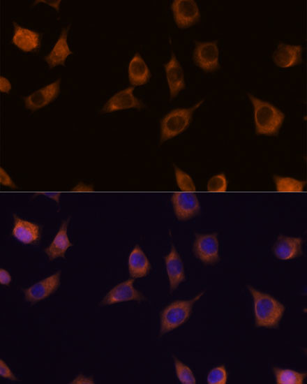 PHLPP2 Antibody in Immunocytochemistry (ICC/IF)