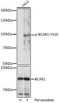 Phospho-BCAR1 (Tyr410) Antibody in Western Blot (WB)