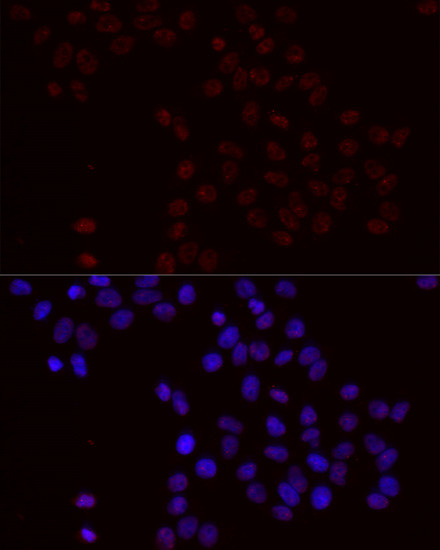 Phospho-BCL2 (Ser70) Antibody in Immunocytochemistry (ICC/IF)