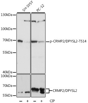 Phospho-CRMP2 (Thr514) Antibody in Western Blot (WB)