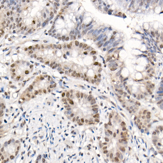 Phospho-4EBP1 (Thr70) Antibody in Immunohistochemistry (Paraffin) (IHC (P))