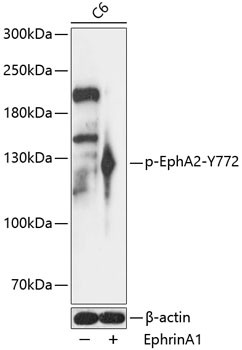 Phospho-EphA2 (Tyr772) Antibody in Western Blot (WB)