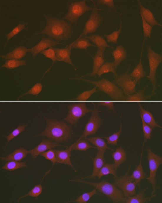 Phospho-FOXO1 (Ser256) Antibody in Immunocytochemistry (ICC/IF)